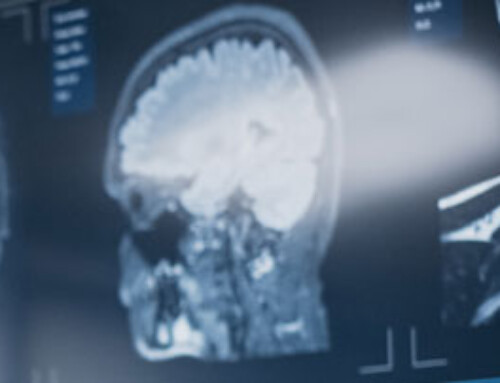 OSIC Traumatic Brain Injury/Concussion Center