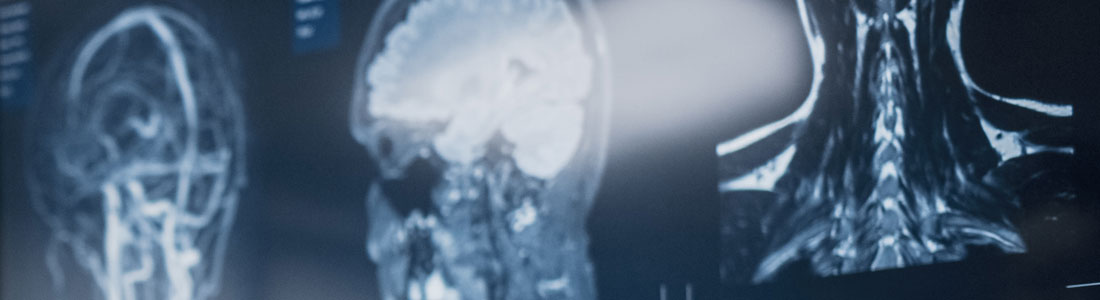 OSIC_BlogHero_Oct2021